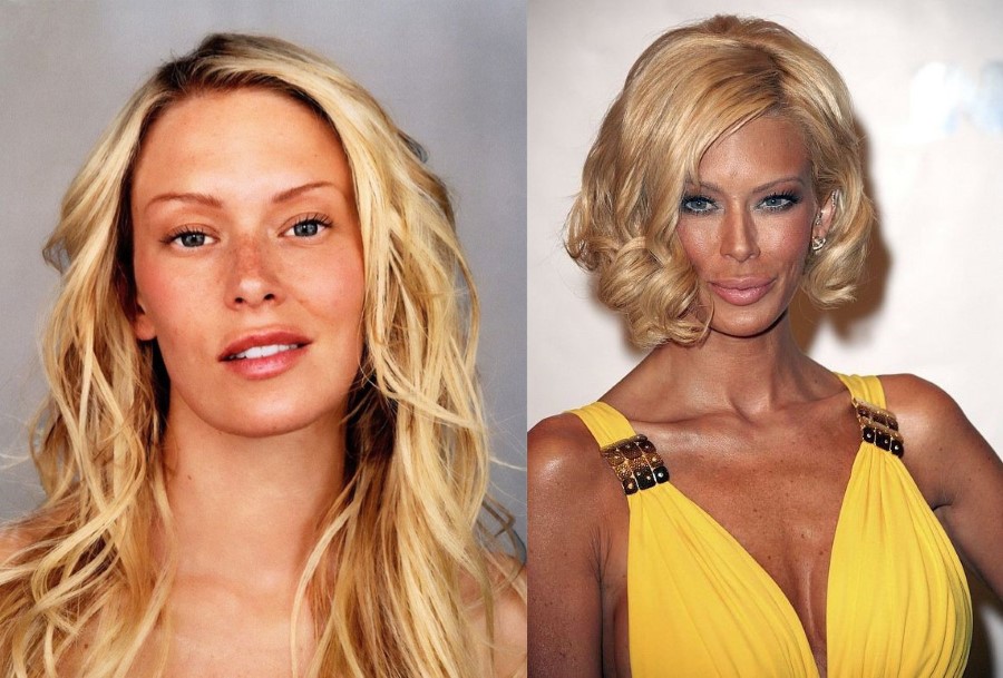 Jenna Jameson Plastic Surgery For Adult Movie Star