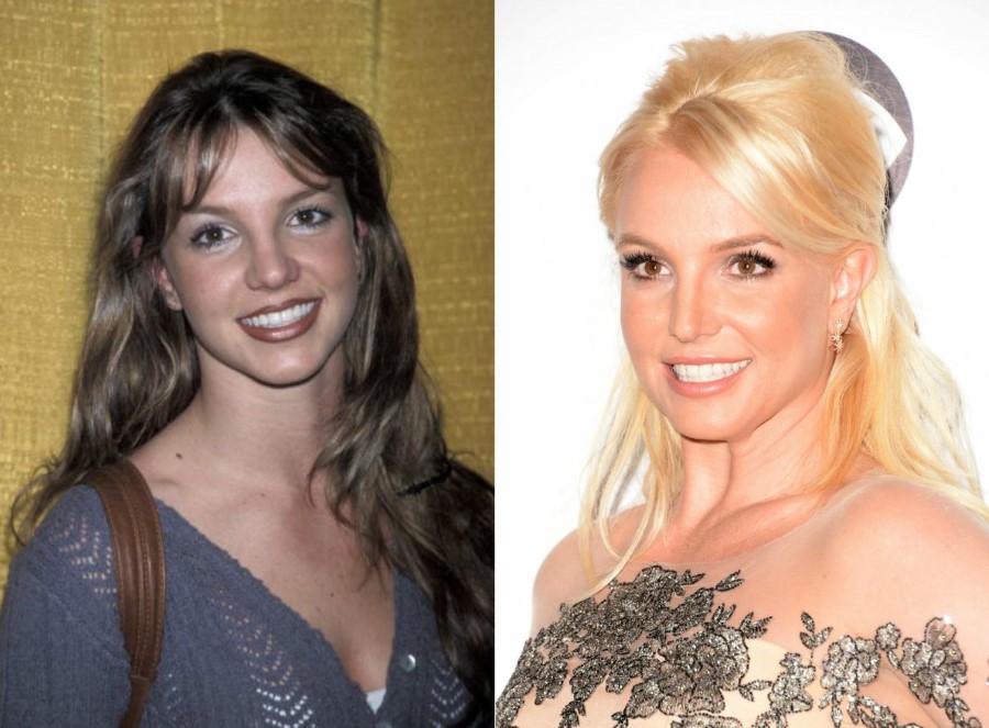 Britney Spears Before And After Plastic Surgery 10 Celebrity Plastic Surgery Online