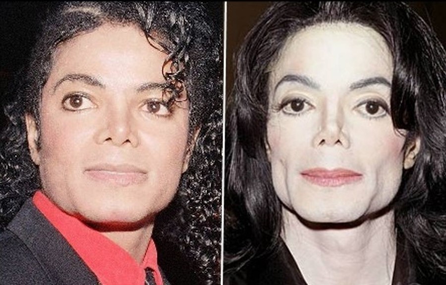 Майкл Джексон До И После Операции Фото Telegraph
