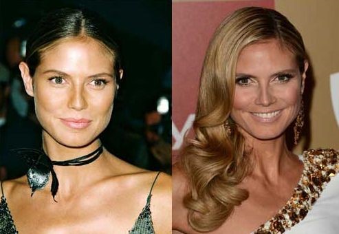 Heidi Klum Before And After Plastic Surgery Celebrity Plastic