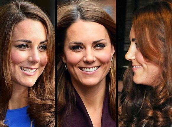 Kate Middleton Before And After Plastic Surgery Celebrity Plastic