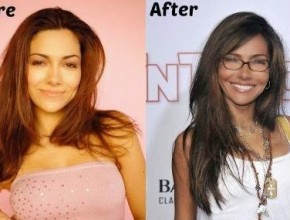 Vanessa Marcil before and after plastic surgery