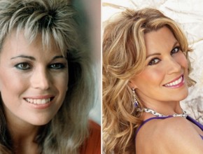 Vanna White before and after plastic surgery