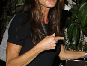 Janice Dickinson after plastic surgery 03