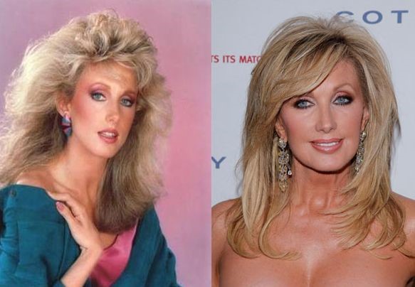 Morgan Fairchild before and after plastic surgery 02 – Celebrity ...