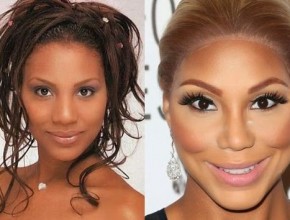 Tamar Braxton before and after plastic surgery 03