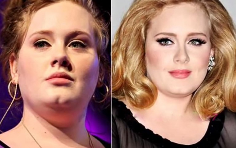 Adele Before And After Plastic Surgery (12) | Celebrity Plastic Surgery ...