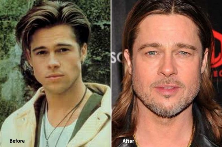 Brad Pitt His Face Looks Really Good After Plastic Surgery!