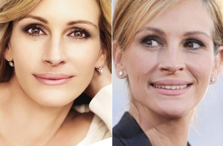 Julia Roberts plastic surgery - aging with more lively looks