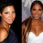 Toni Braxton before and after plastic surgery (32)