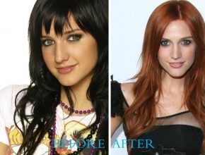 Ashlee Simpson before and after nose job 12