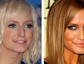 Ashlee Simpson before and after plastic surgery 24