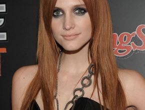 Ashlee Simpson plastic surgery