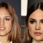 Eiza Gonzalez before and after plastic surgery