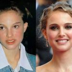 Natalie Portman before and after plastic surgery 34