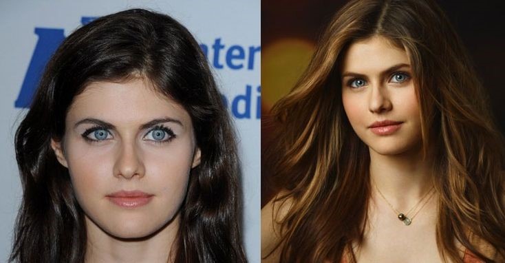 Alexandra Daddario before and after plastic surgery (1) – Celebrity ...