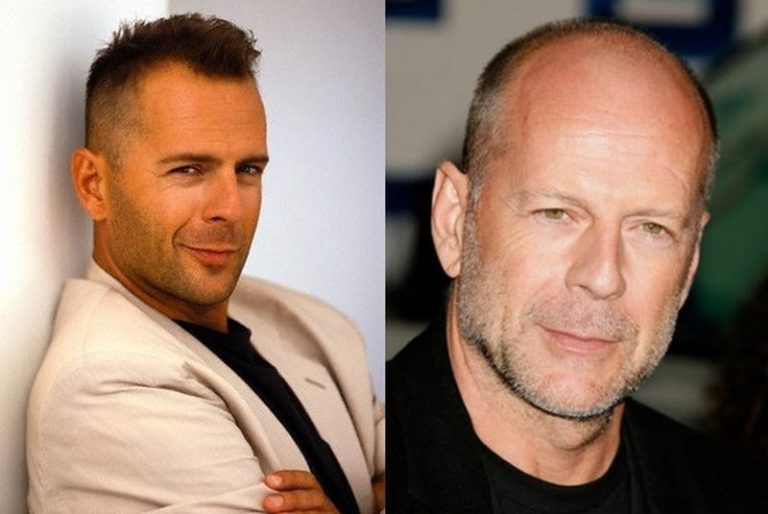 Bruce Willis Masculinity and plastic surgery