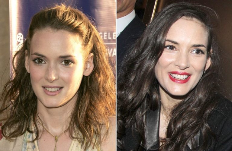 Winona Ryder and plastic surgery procedures