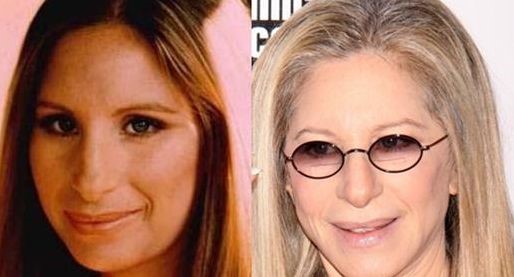 Barbra Streisand before and after plastic surgery (3) – Celebrity ...