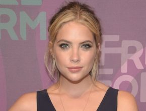 Ashley Benson plastic surgery (4)