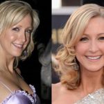 Lara Spencer before and after plastic surgery (1)