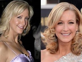 Lara Spencer before and after plastic surgery (1)