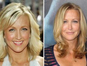 Lara Spencer before and after plastic surgery