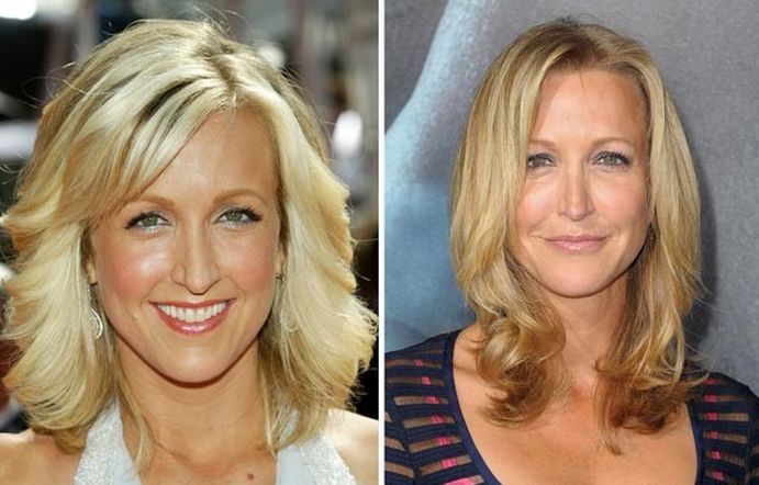 Lara Spencer before and after plastic surgery