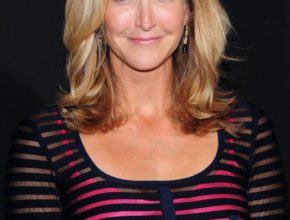 Lara Spencer plastic surgery (1)