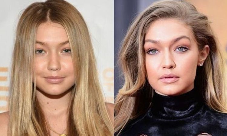 gigi hadid before and after