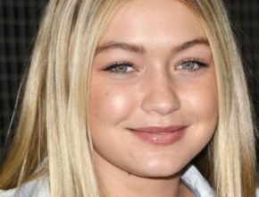 Gigi Hadid plastic surgery (20)